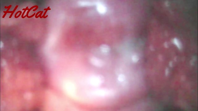 クスコで広げたおまんこ内部♥ アクメキメまくった後の 膣内と子宮口の観察