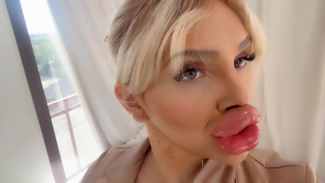 Biggest fake Lips on the WORLD
