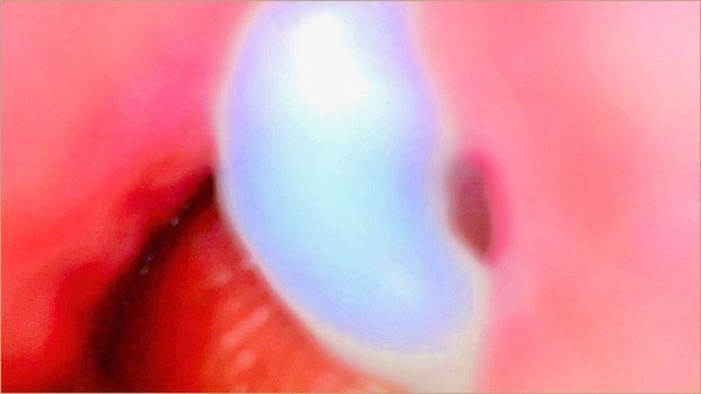 Endoscope Camera Inside My Pink Pussy Records How He Fills Me With Cum💎 - Couple Keyla & Lucas