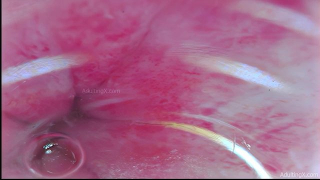 Camera Inside Ass, 9 Throbbing Pulsing Anal Orgasms,  Live Stethoscope Heartbeat - Full Clip