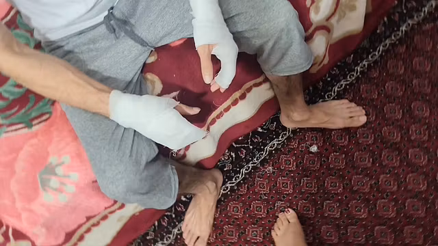 دستم سوخته بود از مادرناتنی درخواست کمک کردم