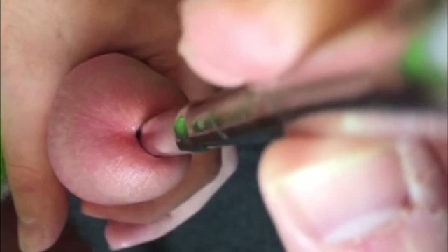 Virgin tries sounding with a 12mm urethral sound
