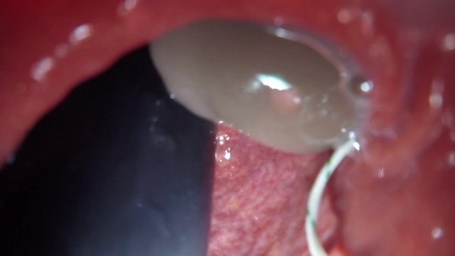 Internal View Two Bad Dragon One Asshole DP Fuck and Cum Quickie