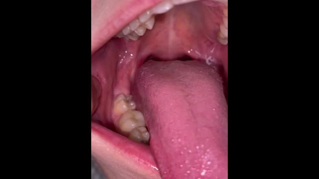 Uvula show. Very close view. Gagging