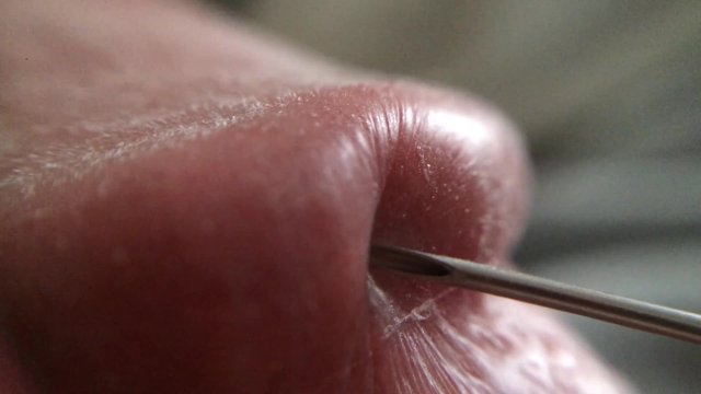 Penis Glans Tissue on Ultra Closeup HD View (Handheld Macro is a Real Challenge)