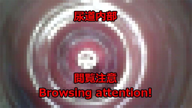 【閲覧注意】内視鏡で尿道オナニー。挿入中に潮吹きして、抜いた瞬間に水が吹き出す様子です。Urethral masturbation with an endoscope.